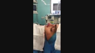 فیلم جراحی انحراف شدید بینی