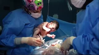 فیلم زایمان سزارین