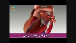 سکته قلبی و نارسایی قلبی