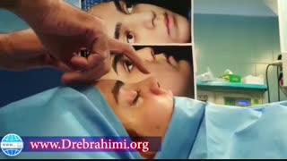 جراحی بینی پهن و قوزدار توسط دکتر امید ابراهیمی بهترین جراح بینی