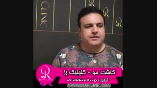فیلم کاشت مو | کلینیک رز | 09104440228 | شماره 75