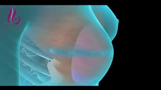 انواع روش هاى بازسازى سینه پس از تخلیه پستان و ماستکتوم