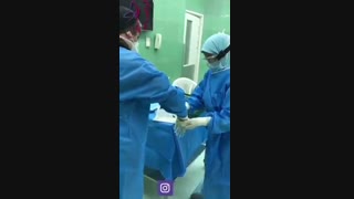 زایمان سزارین