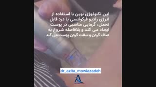جوانسازی پوست با لیزر آر اف فراکشنال جراحی لثه