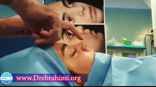 اصلاح پهنا و قوز بینی | دکتر ابراهیمی برداشتن خال