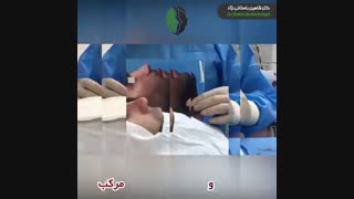 جراحی بینی ترمیمی | دکتر باستانی نژاد جراح بینی