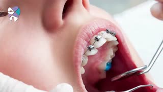 بهترین روش ارتودنسی.متخصص ارتودنسی تهران.دکترعلیرضاخدیوی