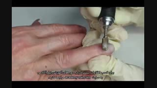 آموزش ترمیم کاشت ناخن : مرحله اول  و دوم  : کوتاه کردن قد ناخن و نازک کردن مواد کاشت ناخن- نیل آکادمی