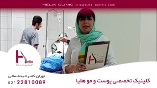 کاشت مو به روش میکروگرافت | کلینیک هلیا | 02122810089 | شماره 63