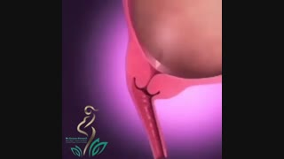 فیلمی کوتاه از روند زایمان طبیعی