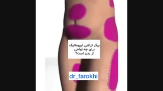 لیپوماتیک چیست ؟