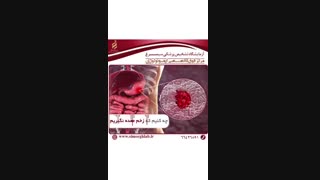 پیشگیری از زخم معده