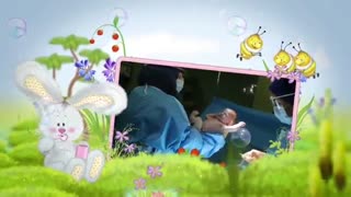 زایمان سزارین