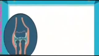 آرتروز زانو