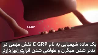 میگرن...