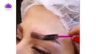 میکرو بلیدینگ در کلینیک ارکیده