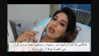 لیزر صورت | پاسخ به سوالات متداول