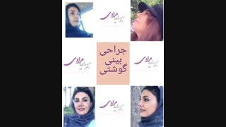 جراحی بینی گوشتی