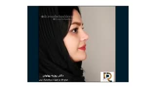 جراحی بینی فانتزی