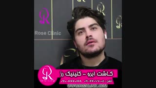 فیلم کاشت ابرو | کلینیک رز | 09104440228 | شماره 205