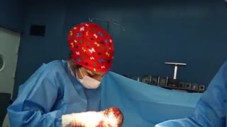 جراحی زایمان سزارین