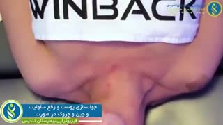 جوانسازى پوست و رفع سلولیت و چین و چروک در صورj