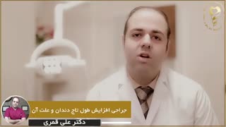 جراحی افزایش طول تاج دندان