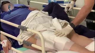 فیلم جراحی تعویض مفصل زانو