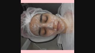 لایه برداری صحیح