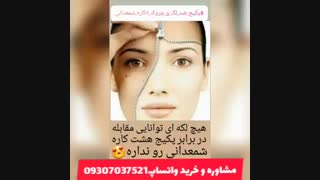 کرم ضدجوش و ضد لک هشت کاره شمعدانی سفارش واتساپ09307037521 کشیدن دندان