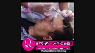 فیلم تزریق بوتاکس | کلینیک رز | 09104440228 | شماره 2