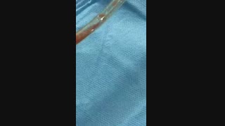 فیلم پیکرتراشی با سیستم پال در حین عمل