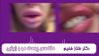 تزریق ژل نامرغوب