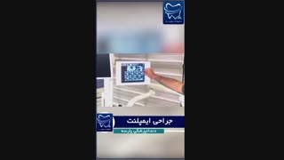 جراحی ایمپلنت