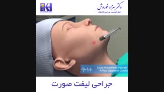 جراحی لیفت صورت