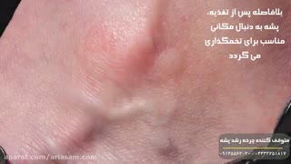 پشه، حشره قاتل - سم ریشه کن کننده پشه