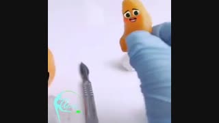 انیمیشن بانمک زایمان سزارین