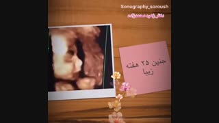 سونوگرافی جنین در هفته 25