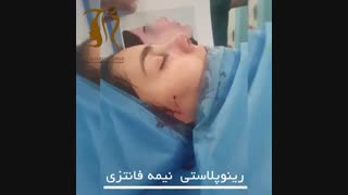فیلم جراحی بینی نیمه فانتزی