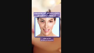 تاثیر شگفت انگیر لیزر فراکشنال در جوانسازی پوستی