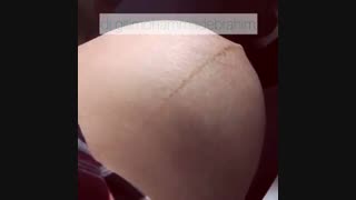حرکت جنین در رحم