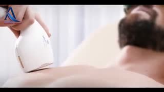 لیزر موهای زائد صورت و بدن