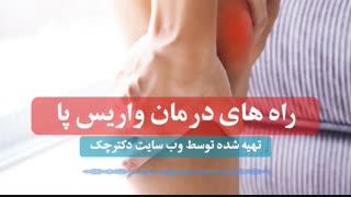 درمان سریع  واریس پا با انجام این 6 راهکار خانگی