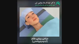 ابدومینوپلاستی | فوق تخصص جراحی پلاستیک و زیبایی | دکتر عبدالرضا روئین تن