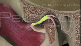 مشکلات مفصل فک