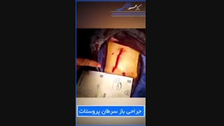 فیلم جراحی باز سرطان پروستات توسط دکتر رنجبری