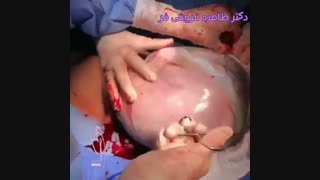 فیلم بسیار زیبا از جنین در مایع آمنیوتیک خارج از شکم