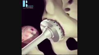 فیلم مراحل جراحی تعویض مفصل لگن