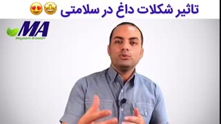 تاثیر شکلات داغ بر سلامتی