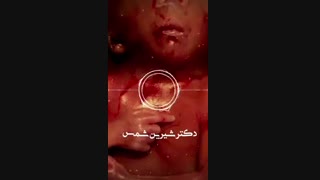 فیلم جنین با یک سر و دو بدن!!!!!